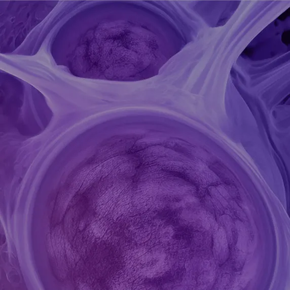 Muscle Engineering for Human Transplant